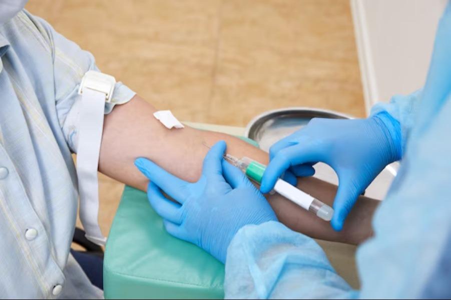 autoimmune liver disease detec