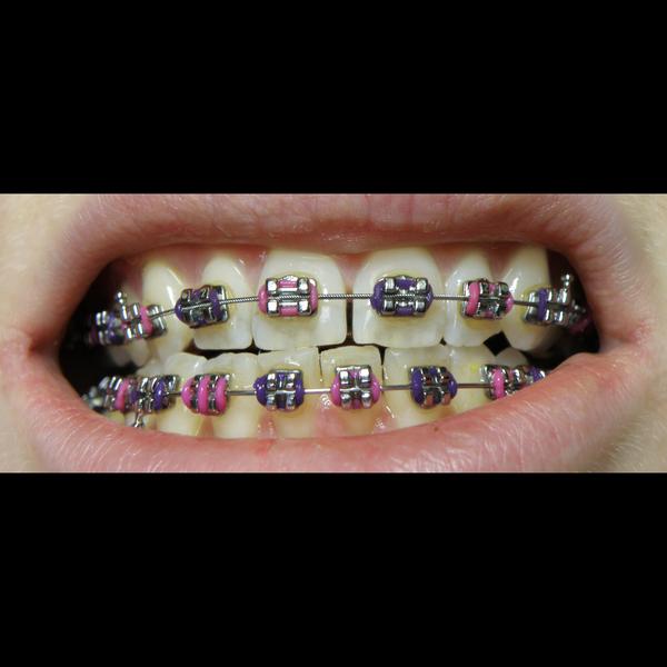 expert orthodontists jaipur