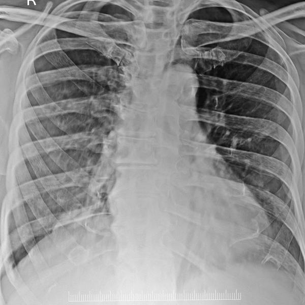 mobile diagnostic imaging serv