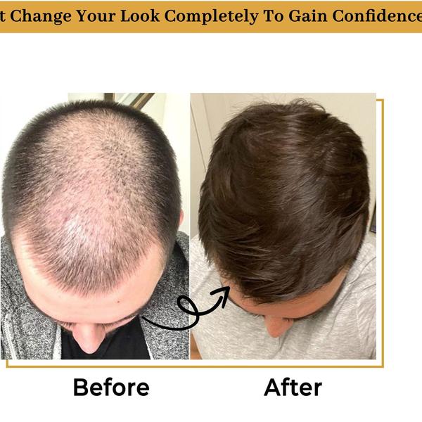 Hair Patch