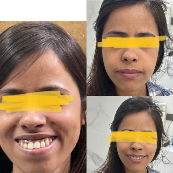 update image