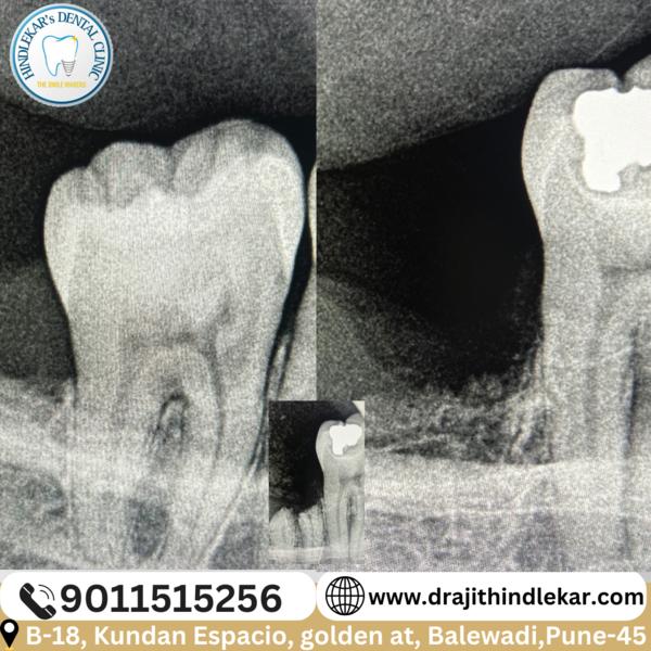 update image