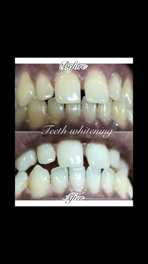 update image
