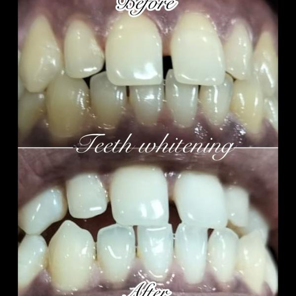 update image