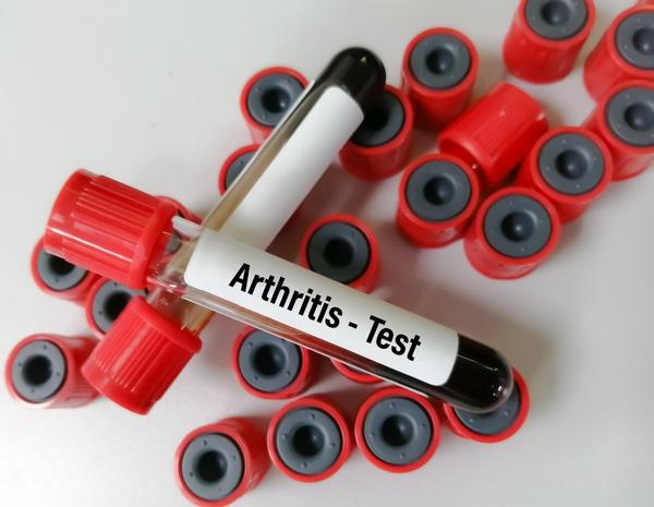 Joint pain