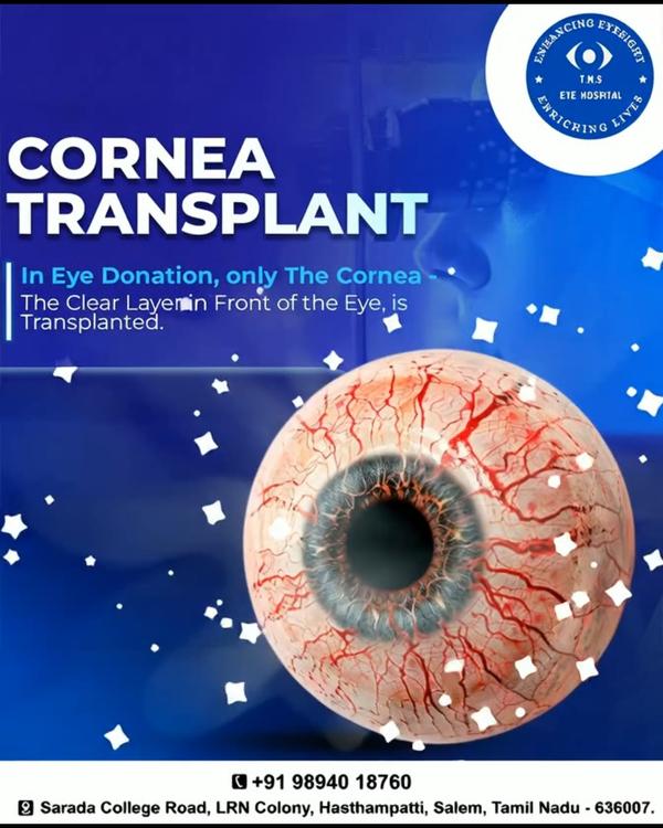 cornea transplant surgery sale