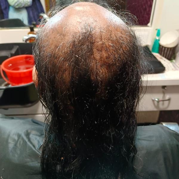 Chemotherapy Hair Wig Center Near Me Nag