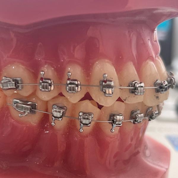 update image
