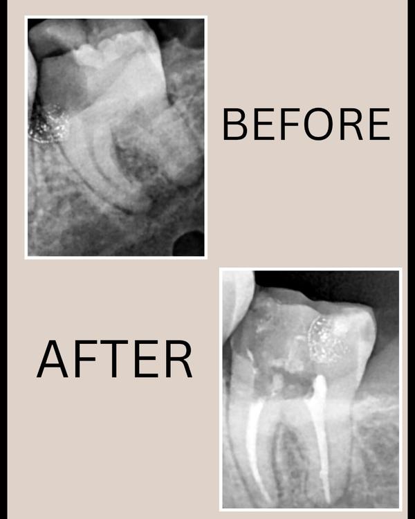 update image