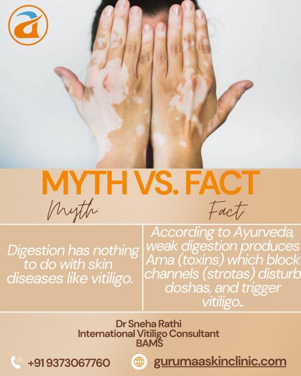 ✨ Consult with Dr. Sneha Rathi – Ayurvedic Vitilig