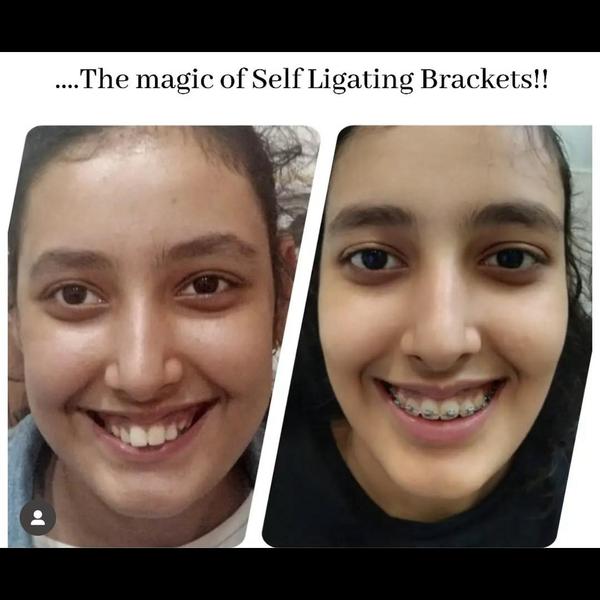 update image