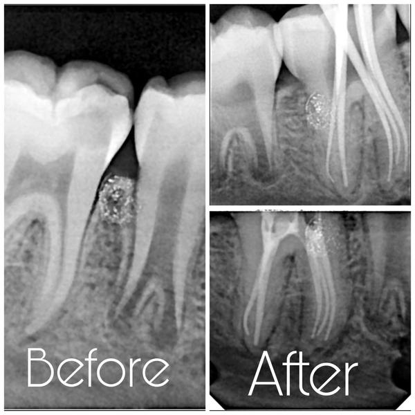 update image