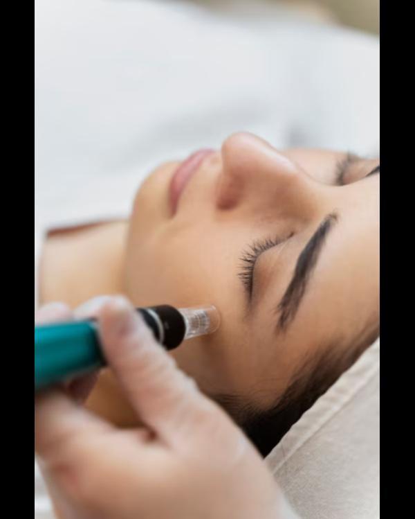 professional procedure