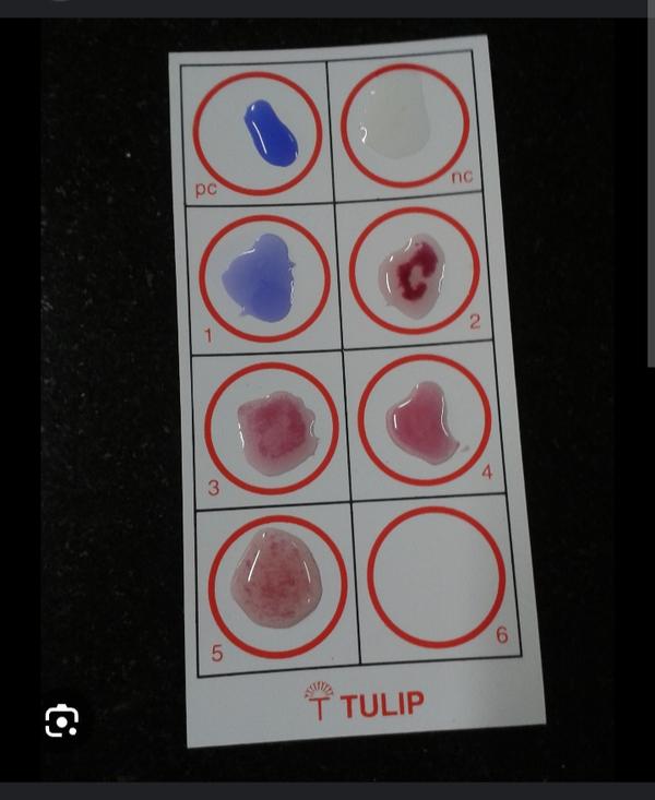 widal test blood serum analysi