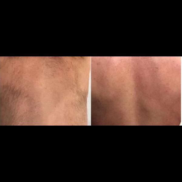 Male Body Wax In Mumbai 
