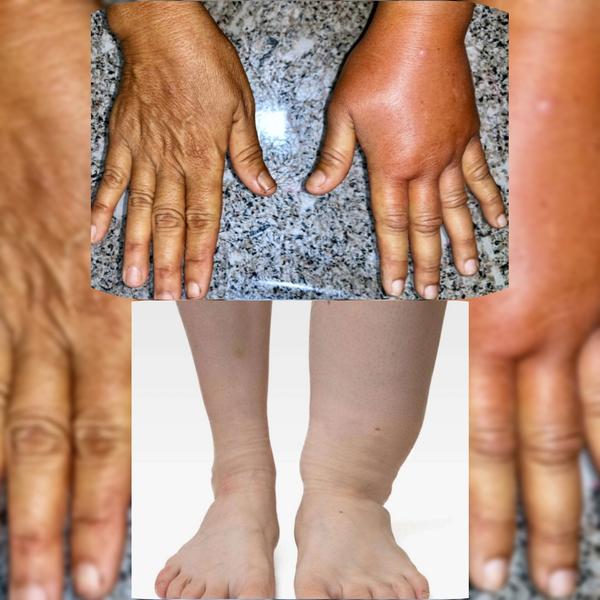 deep tissue release physiother