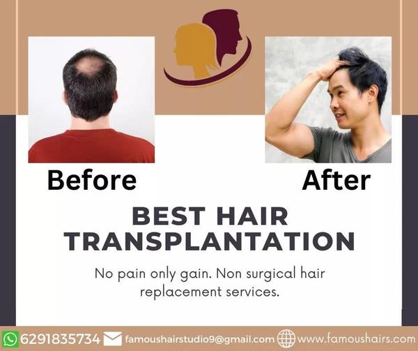 hair patch