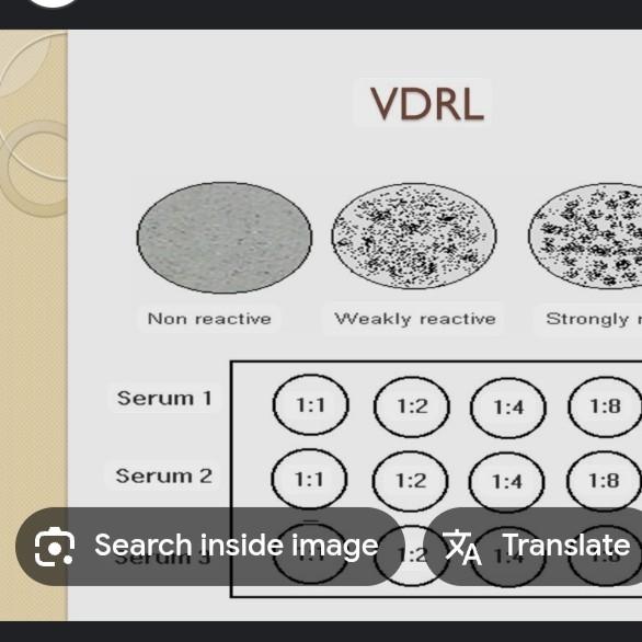 sperm antibody total serum tes