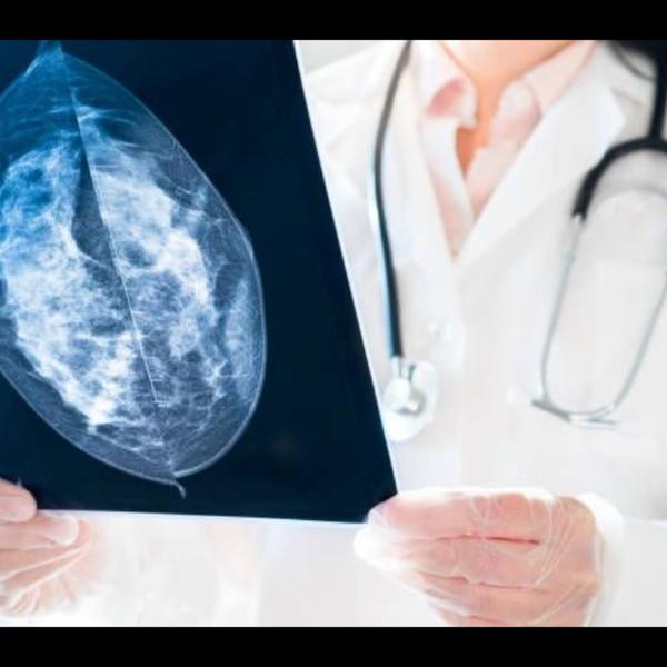 ultrasound breast imaging for 