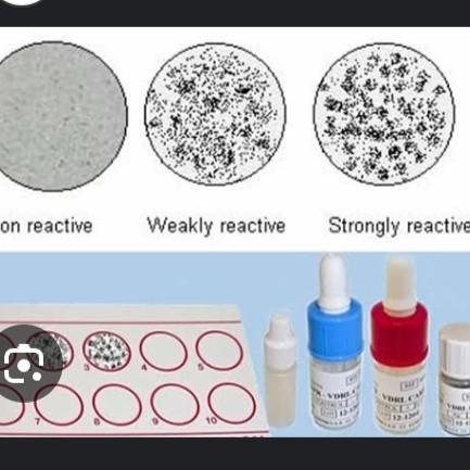 infection control microbiologi
