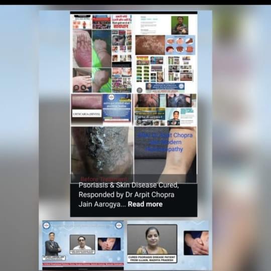 update image