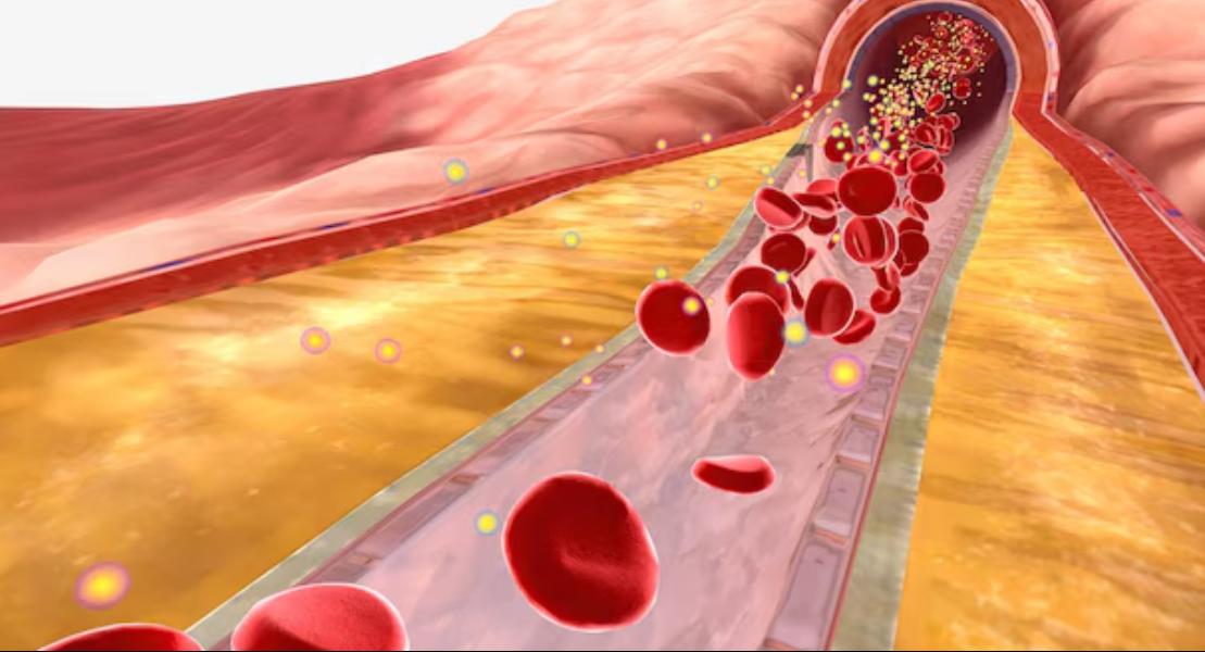 Poor blood circulation can lead to a ran