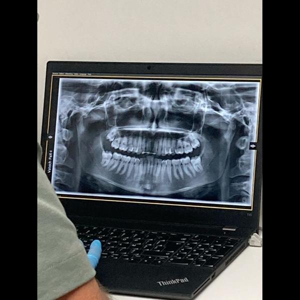 lower jaws purpose