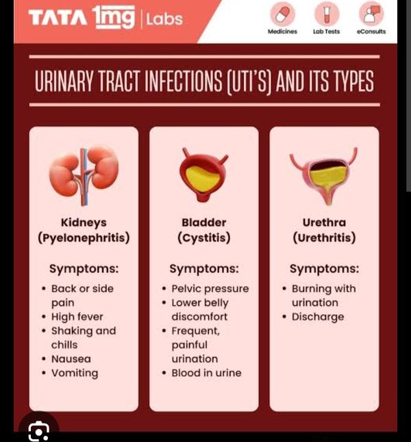 urine culture and sensitivity 