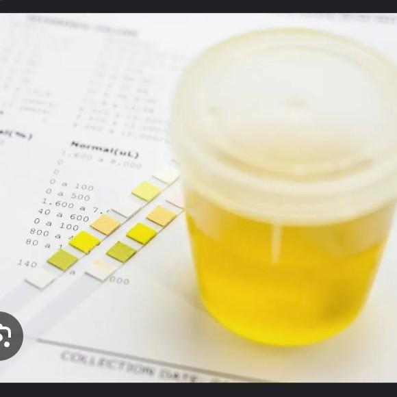 inexpensive rickettsial diseas