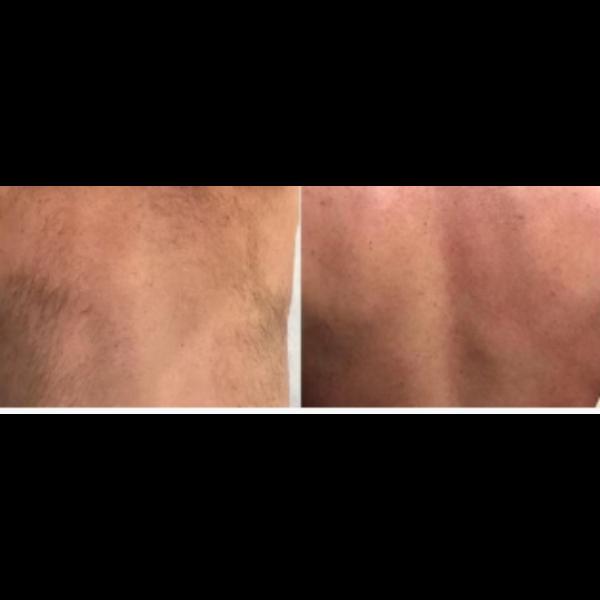 Male Body Wax In Mumbai

