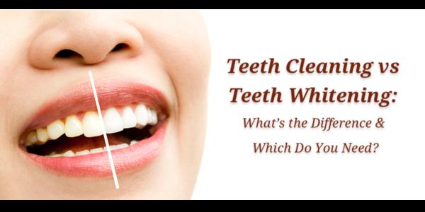✨ Teeth Cleaning vs. Teeth Whi