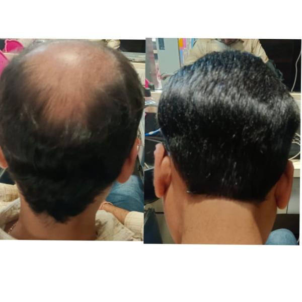 Hair Fixing in Nagpur | Sai Natural Beau