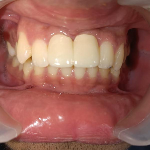 update image