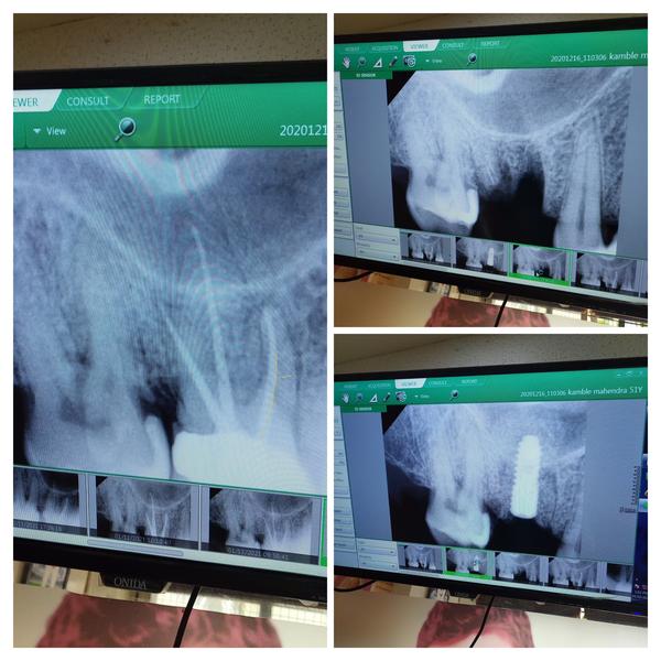 update image