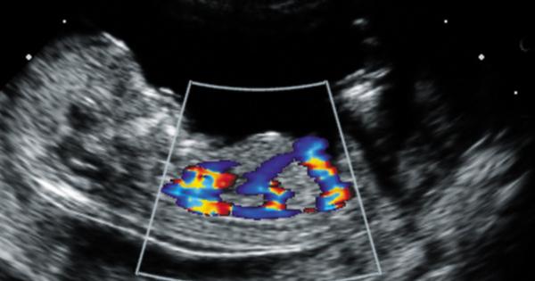 specialized blood diagnostics 