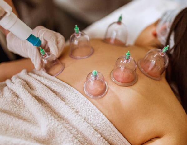 hijama therapy in delhi