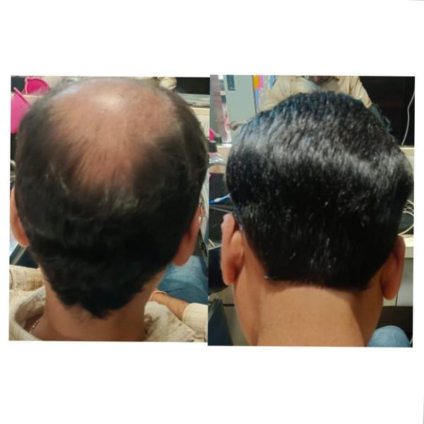 Transform Your Look with Hair Weaving! �