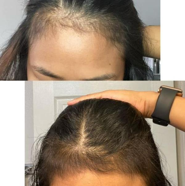 update image