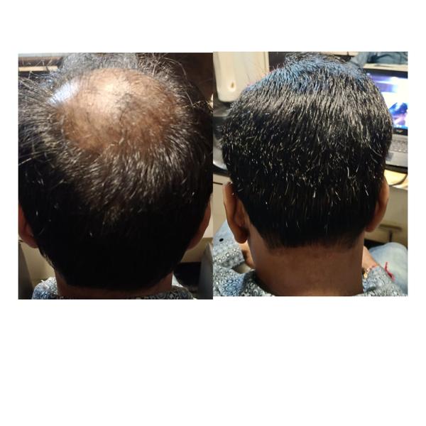 Get the Perfect Look with Premium Hair W