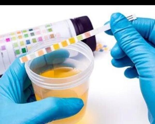 urine routine and culture test