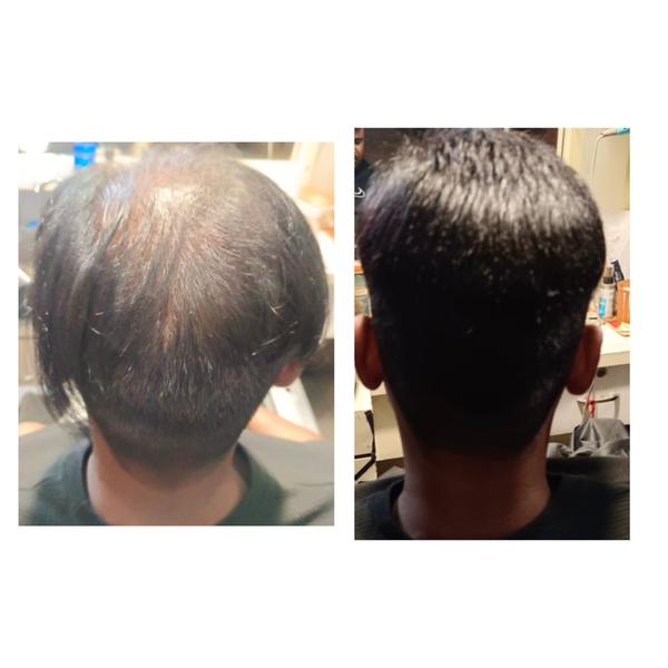 Hair Fixing in Nagpur | Sai Natural Beau