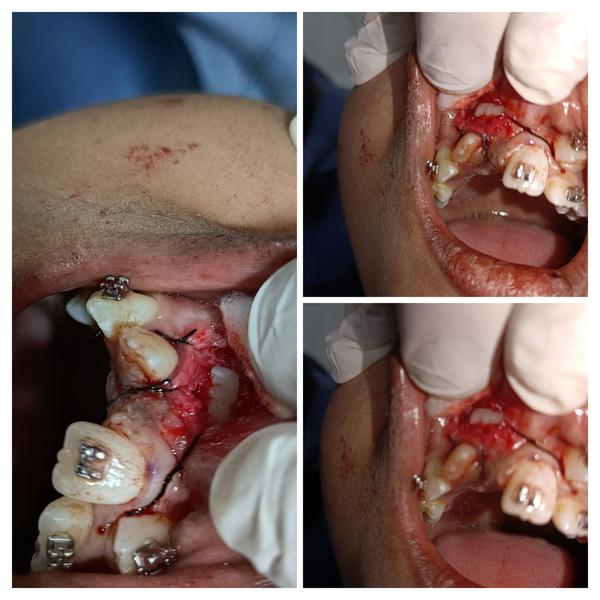 update image