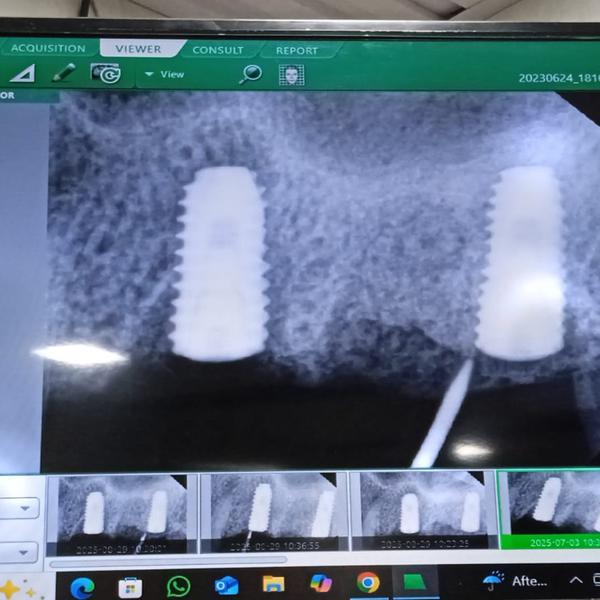 update image