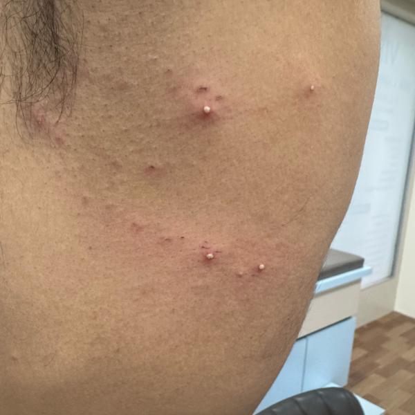 experienced skin infection doc