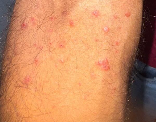 skin disease doctor in woraiyu