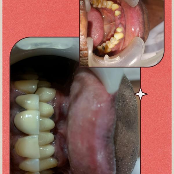 update image