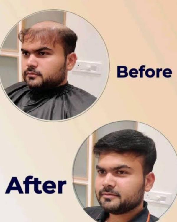 Hair Wigs for Men – Regain You