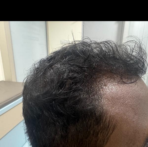 gfc treatment thillai nagar