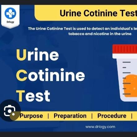 histamine metabolite 1methylhi