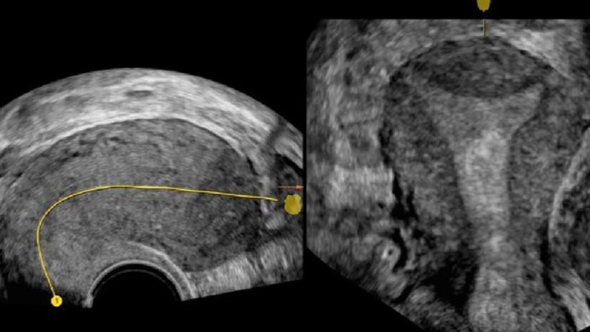 fertility assessment rohini de